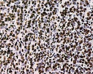 Ribonucleoproteins