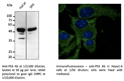 Anti-P53 Antibody