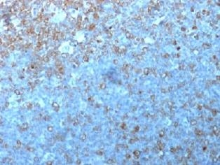Cdk1/p34cdc2