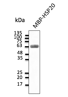 Anti-HSP20 Antibody