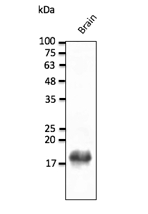 Anti-SNCB Antibody