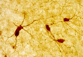 神经肽Y抗体